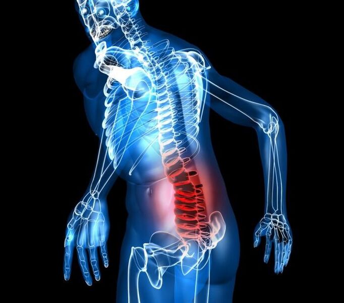 Degree and Development Internships of Lumbar Osteochondrosis
